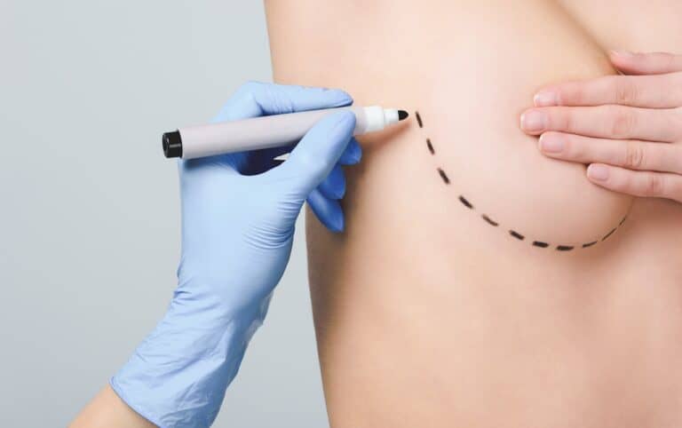 Breast Reduction Plastic Surgery