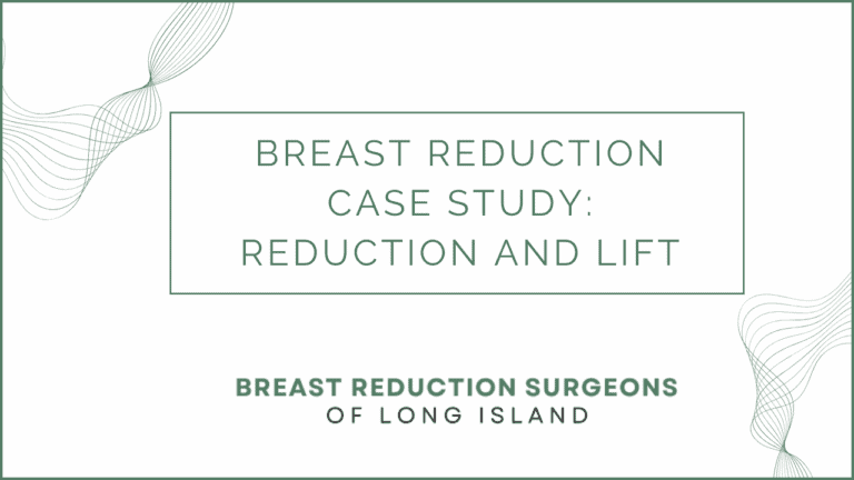 Breast Reduction and Lift Case Study