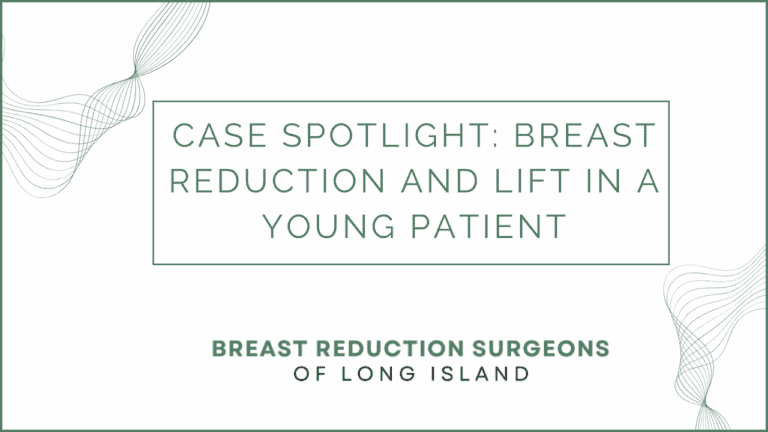 Case Spotlight Breast Reduction and Lift in a Young Patient