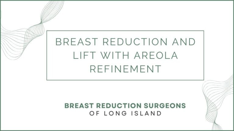Breast Reduction and Lift with Areola Refinement