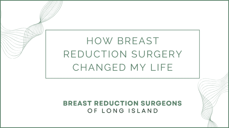 How Breast Reduction Surgery Changed My Life