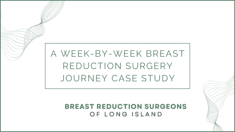 LI Breast Reduction Case Study Journey