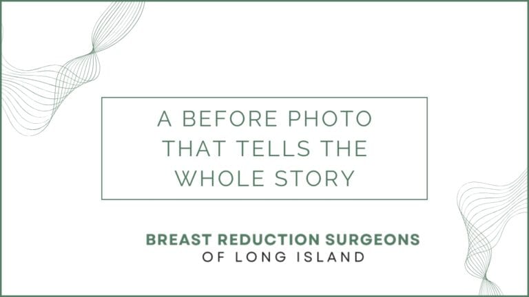 Case Study: A Before Photo That Tells the Whole Story